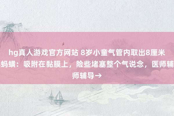 hg真人游戏官方网站 8岁小童气管内取出8厘米活体蚂蟥：吸附在黏膜上，险些堵塞整个气说念，医师辅导→